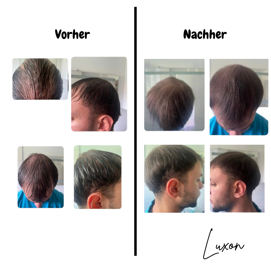 HairVibe Pro I Kopfhautmassagegerät